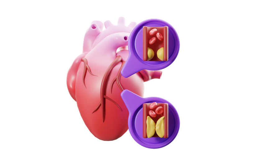 EHRs and Chronic Disease Management